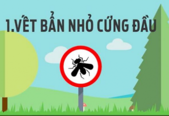 Tổng hợp những nguyên nhân chính gây hại lớp sơn xe ô tô Tổng hợp những nguyên nhân chính gây hại lớp sơn xe ô tô